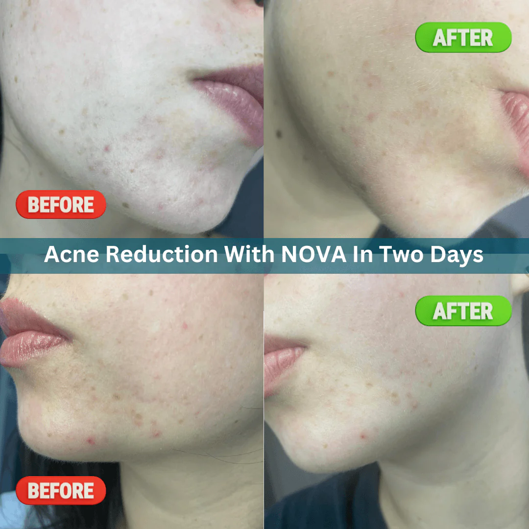 Nova Rejuvenation Kit – Solid Serum & Moisturizer Set - Image 7