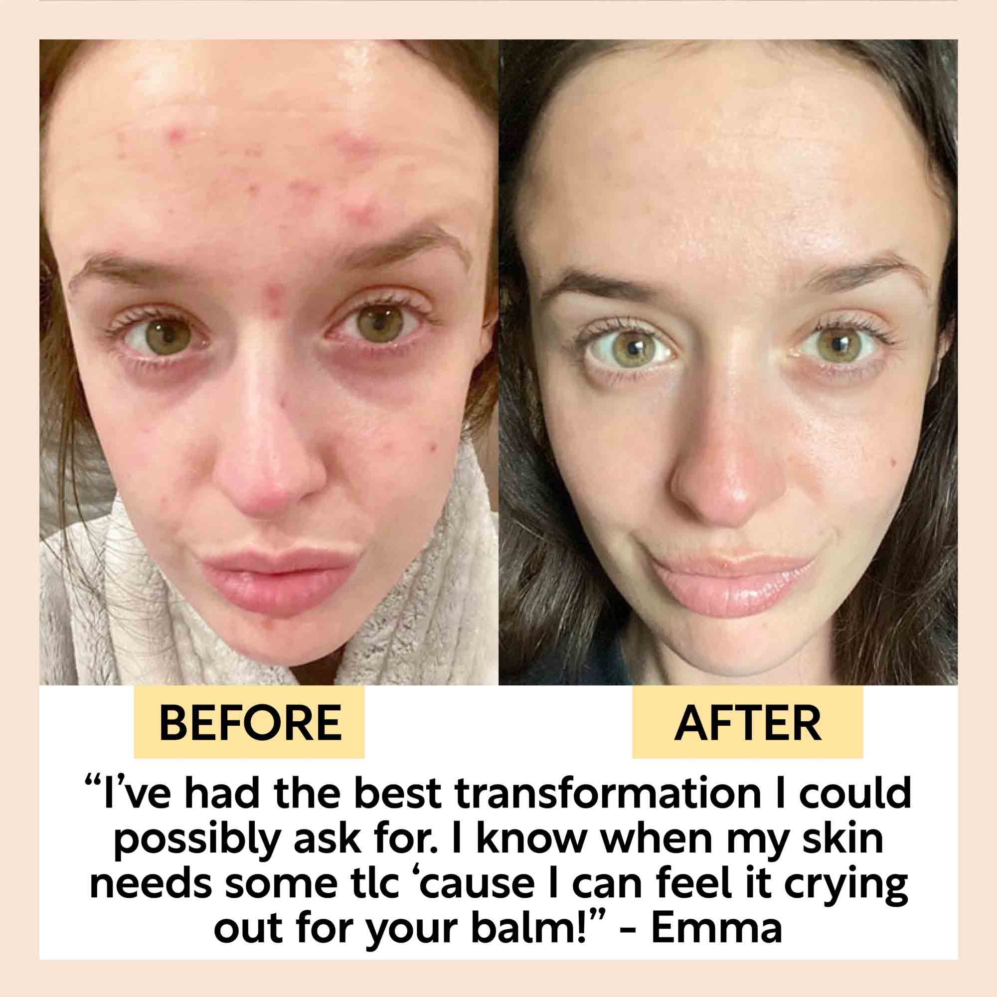 Cleansing Face Balm - Image 10