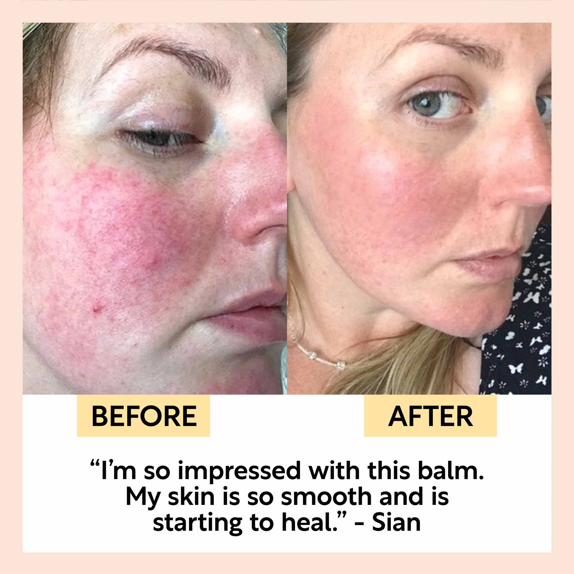 Cleansing Face Balm - Image 9