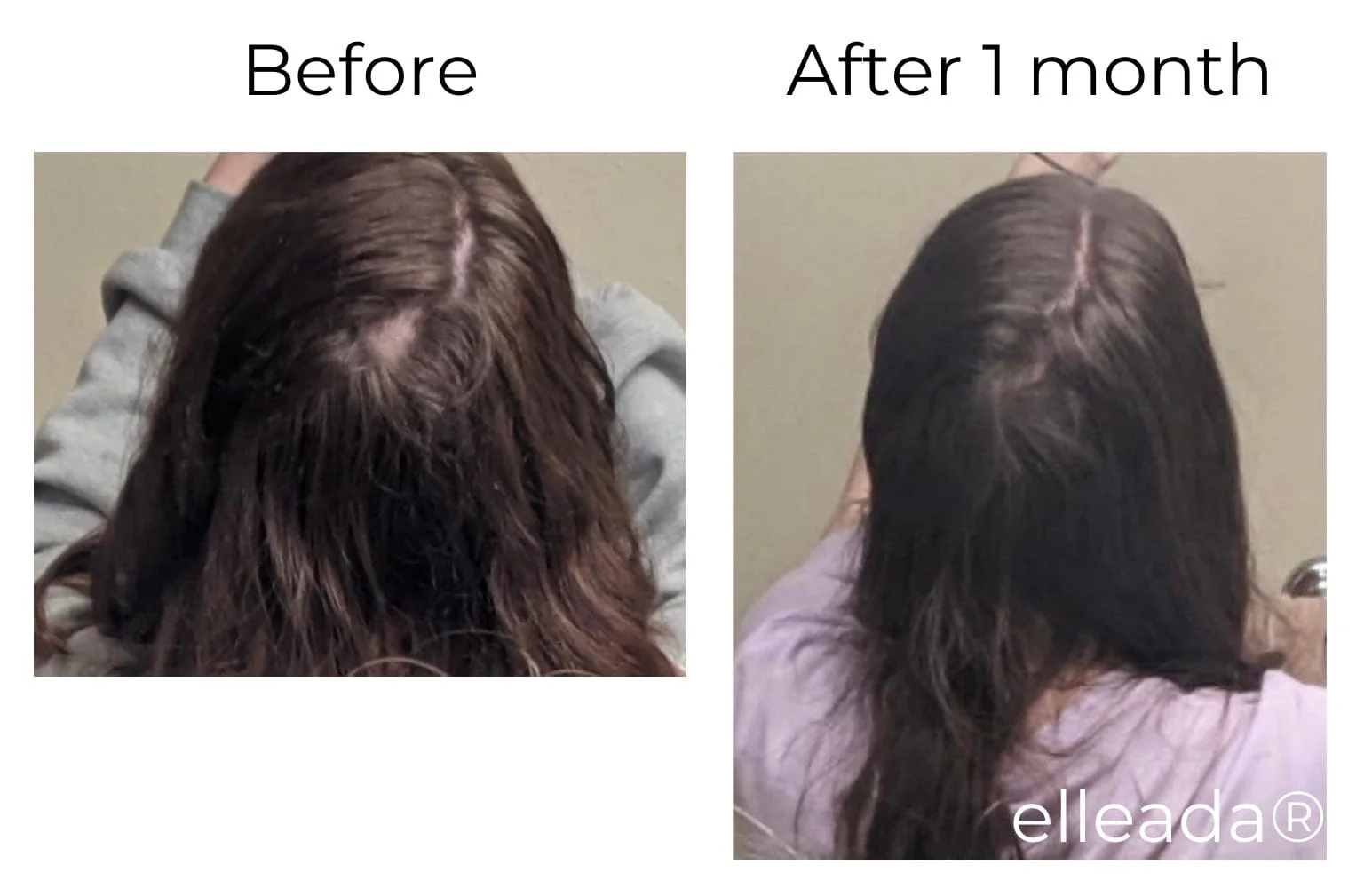 Vegan Hair Strengthening Serum – Natural Relief for Hair Loss & Itchy Scalp - Image 11