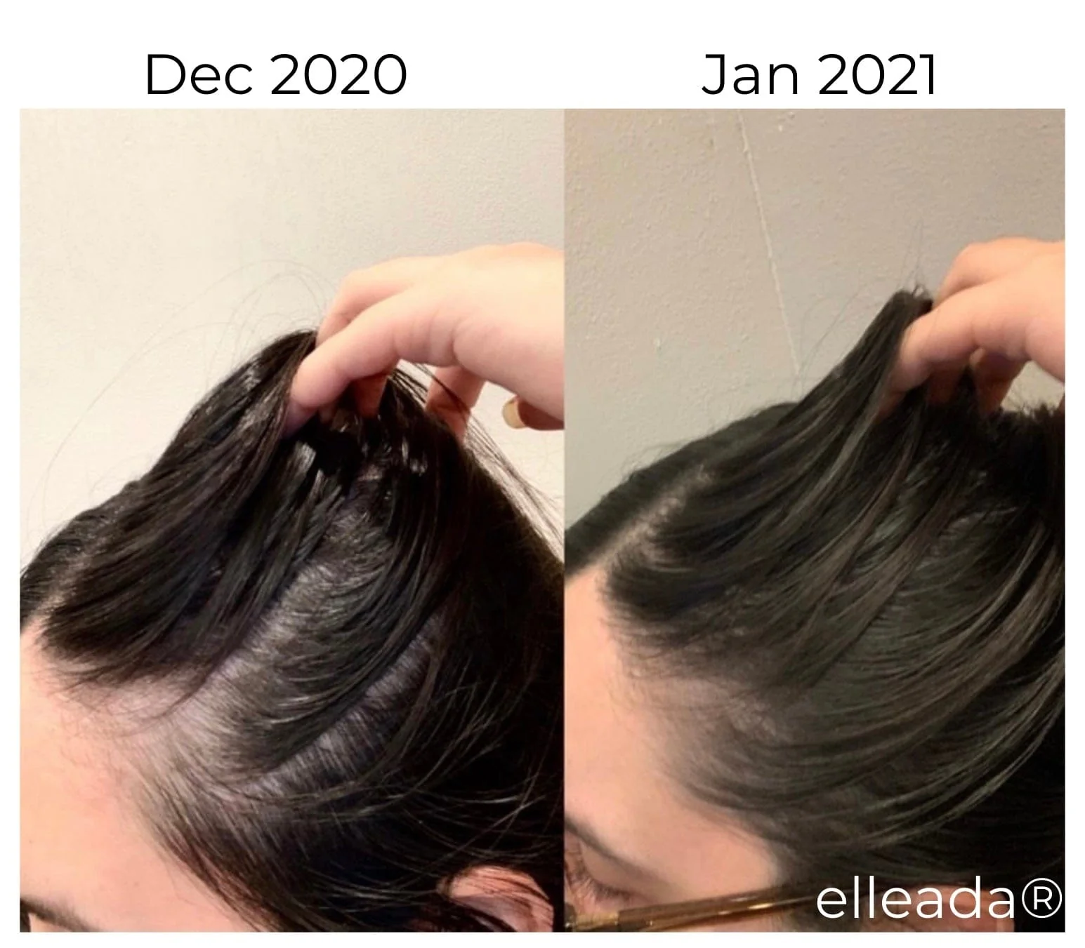 Vegan Hair Strengthening Serum – Natural Relief for Hair Loss & Itchy Scalp - Image 12