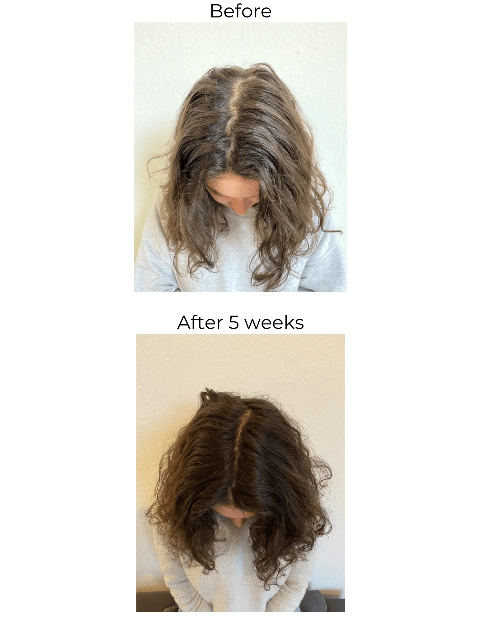 Vegan Hair Strengthening Serum – Natural Relief for Hair Loss & Itchy Scalp - Image 14