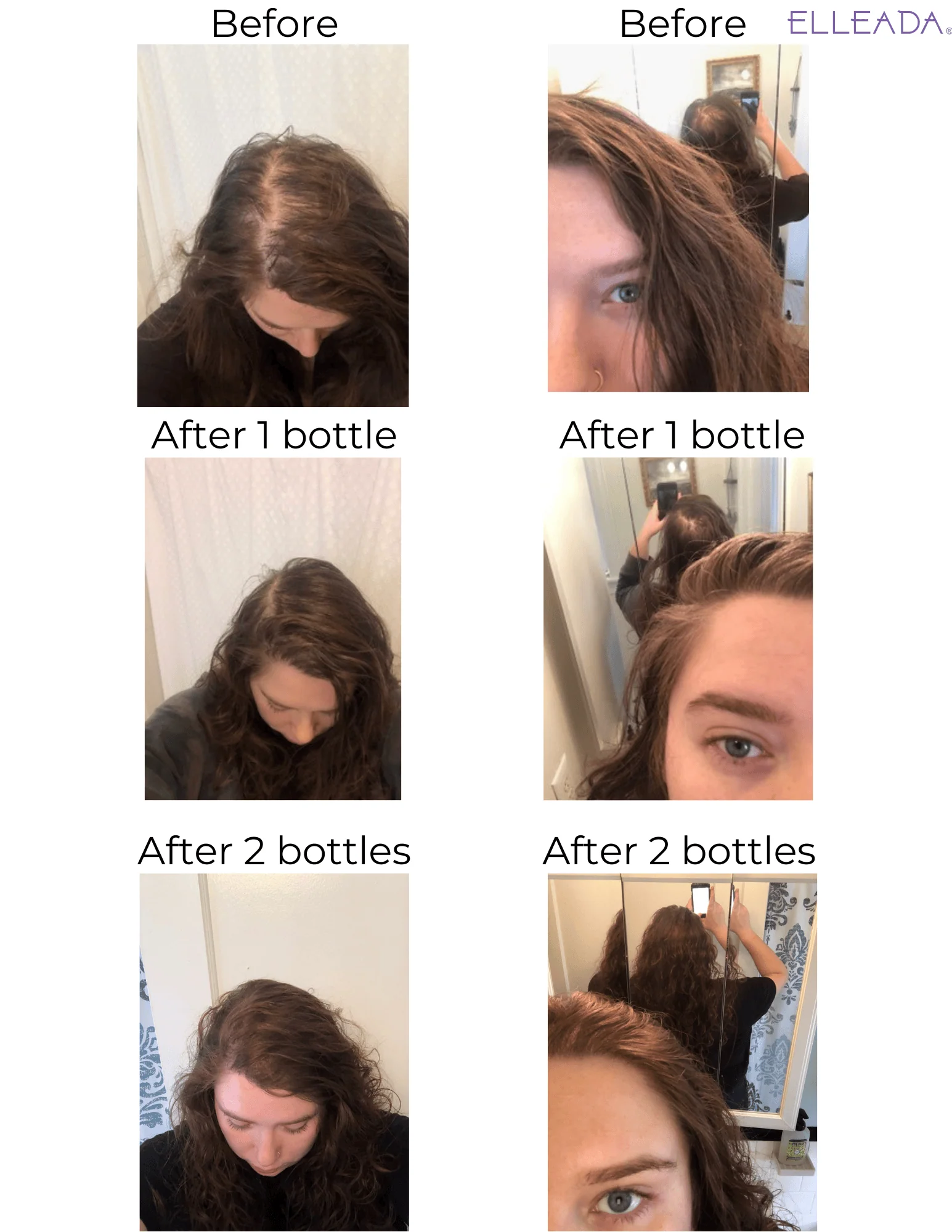 Vegan Hair Strengthening Serum – Natural Relief for Hair Loss & Itchy Scalp - Image 15