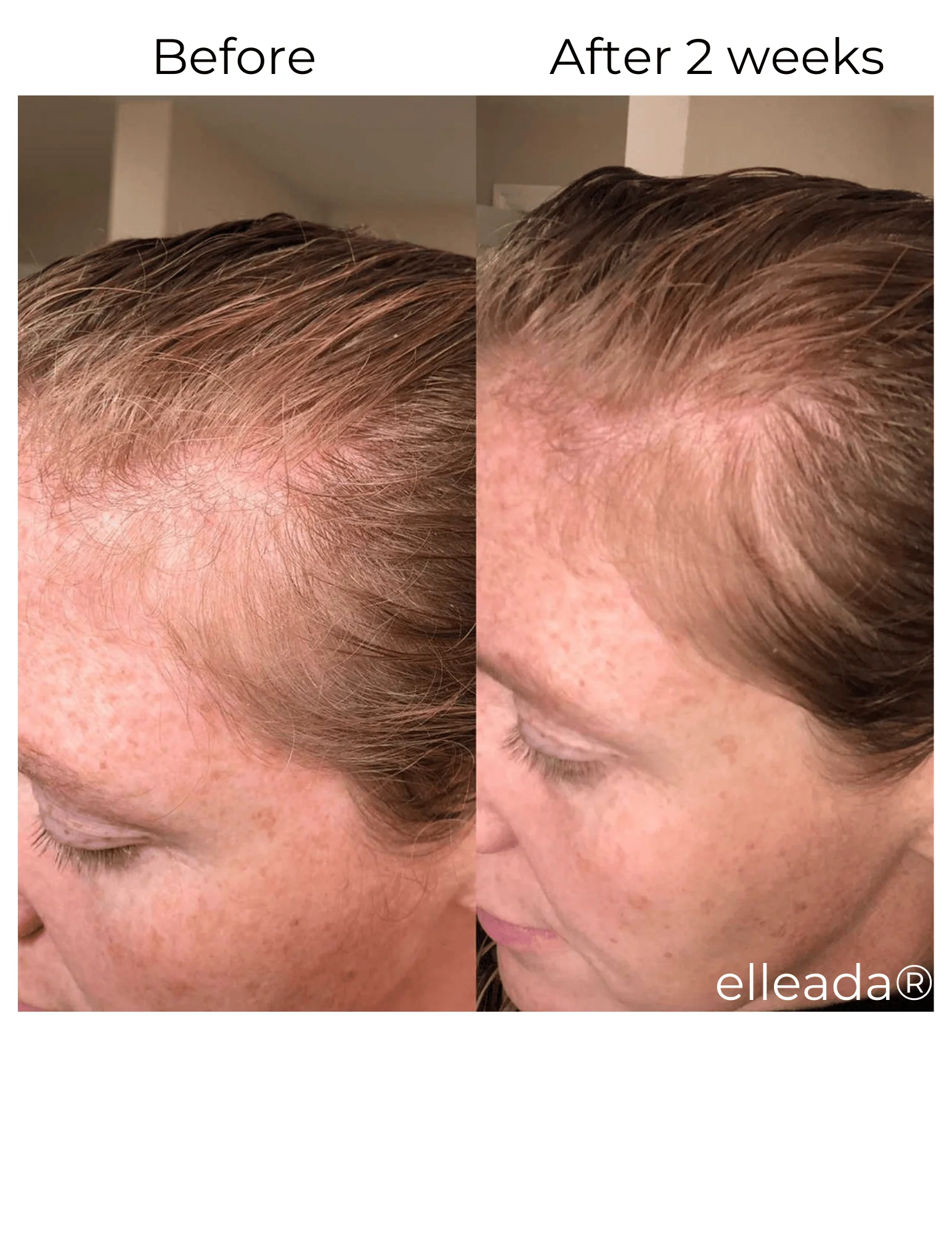 Vegan Hair Strengthening Serum – Natural Relief for Hair Loss & Itchy Scalp - Image 16