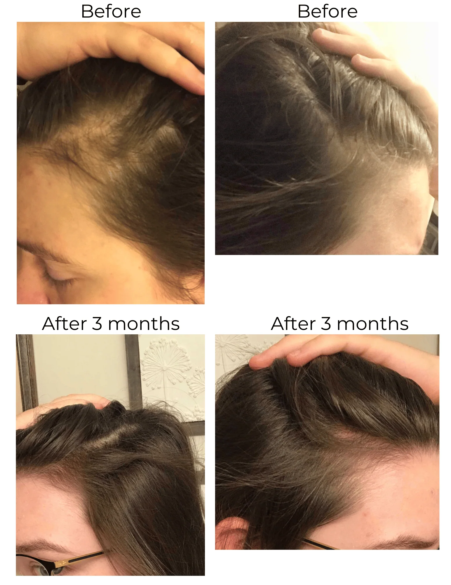 Vegan Hair Strengthening Serum – Natural Relief for Hair Loss & Itchy Scalp - Image 17