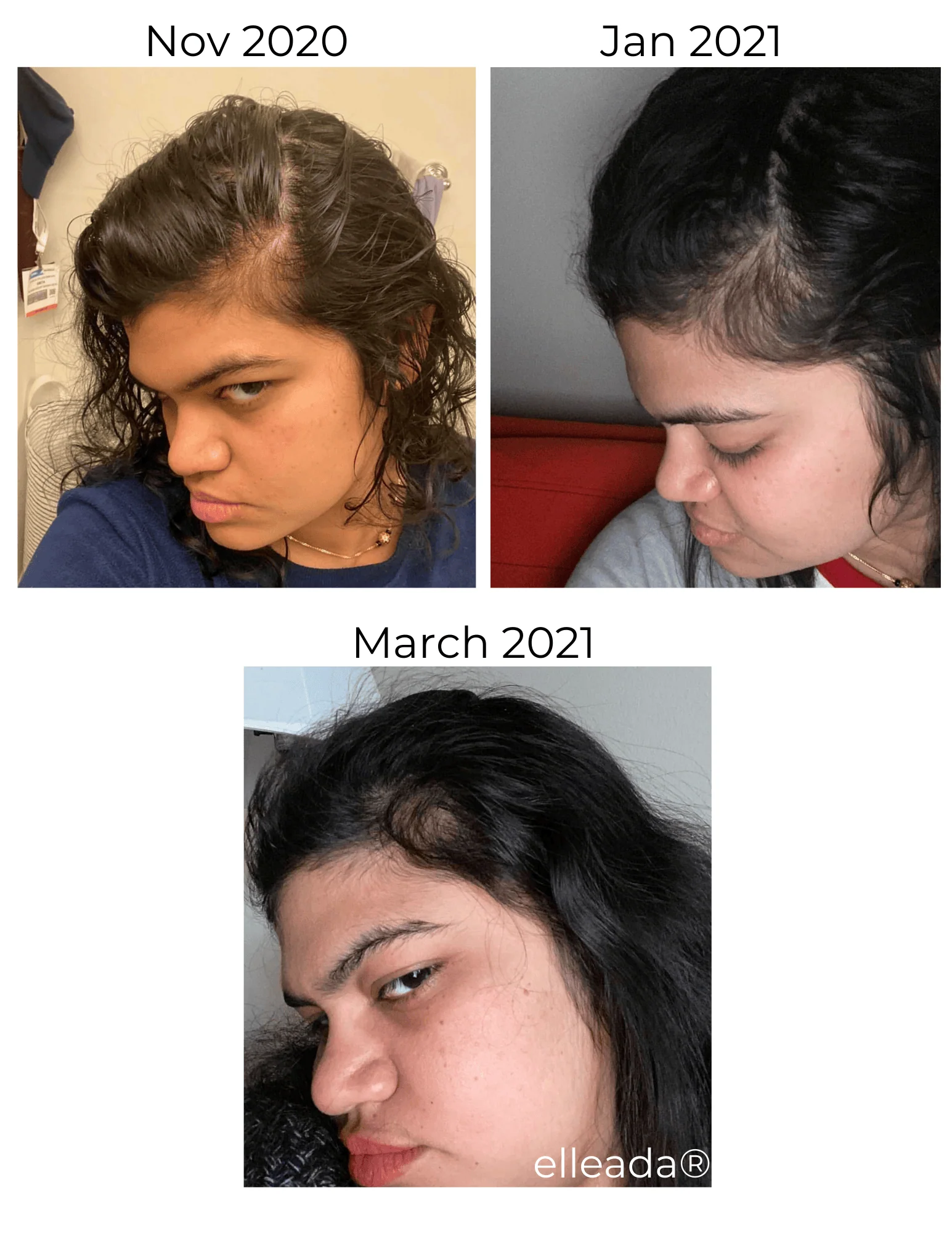 Vegan Hair Strengthening Serum – Natural Relief for Hair Loss & Itchy Scalp - Image 18