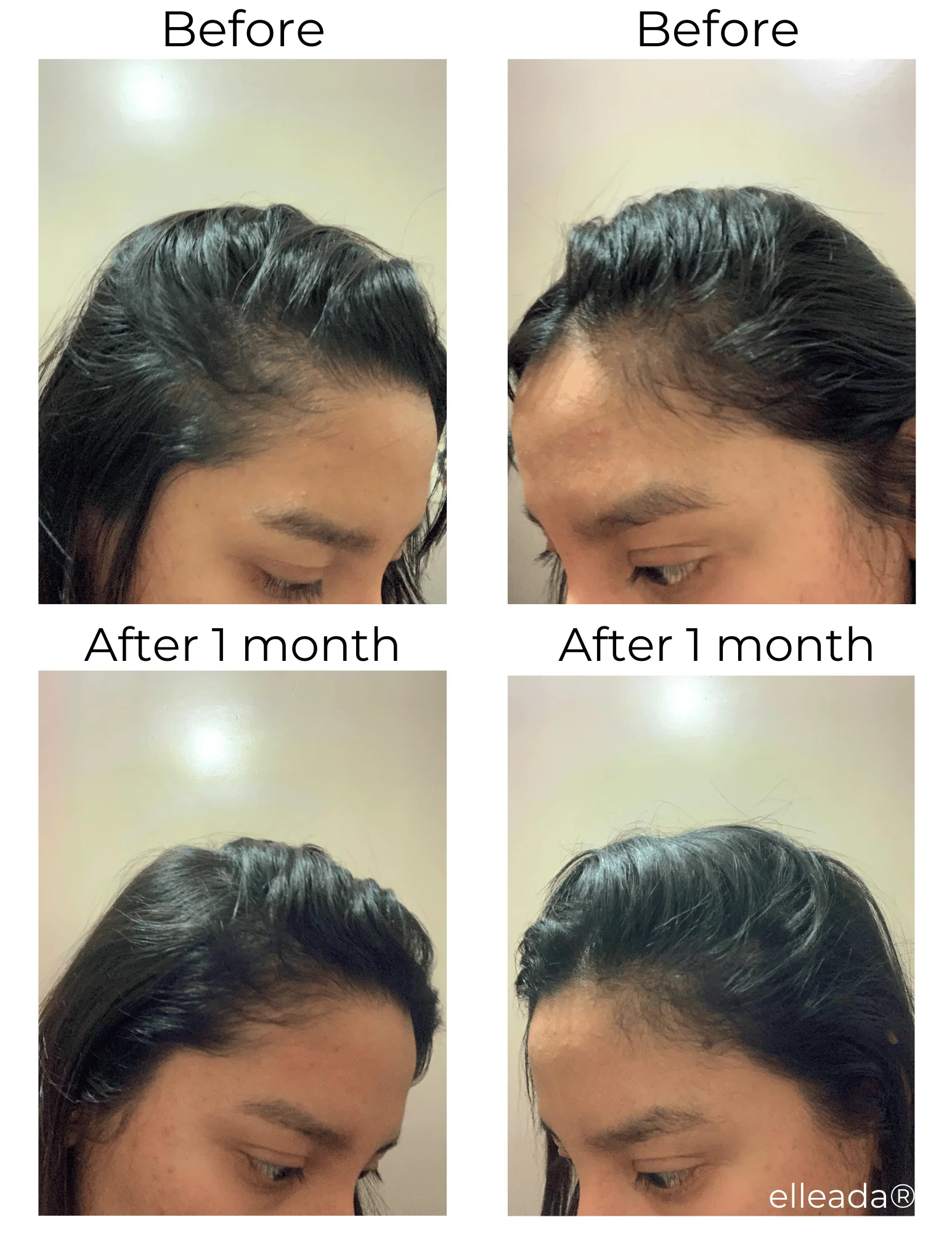 Vegan Hair Strengthening Serum – Natural Relief for Hair Loss & Itchy Scalp - Image 19