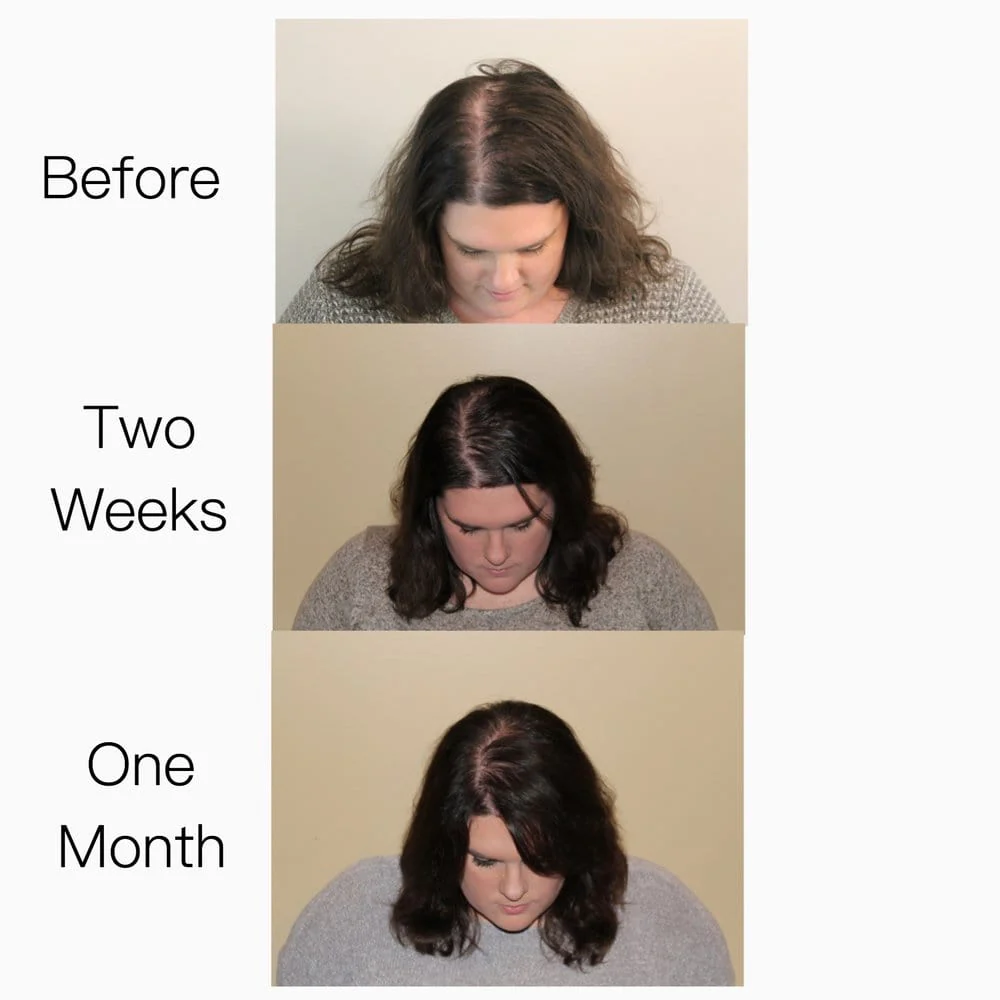 Vegan Hair Strengthening Serum – Natural Relief for Hair Loss & Itchy Scalp - Image 2