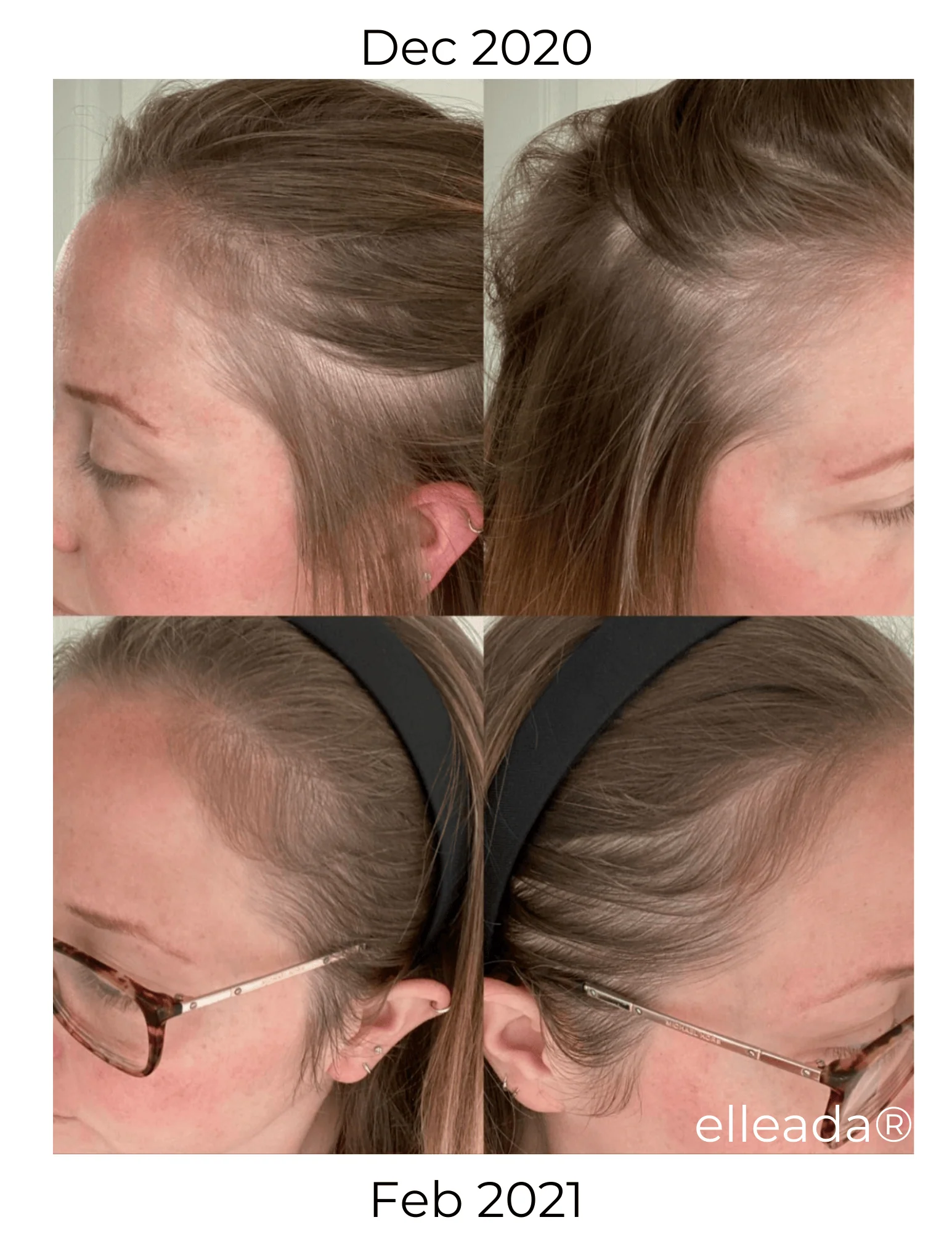 Vegan Hair Strengthening Serum – Natural Relief for Hair Loss & Itchy Scalp - Image 20