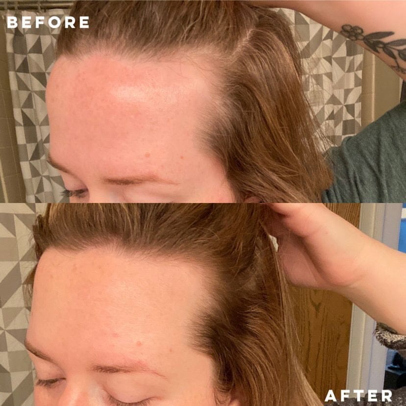Vegan Hair Strengthening Serum – Natural Relief for Hair Loss & Itchy Scalp - Image 21