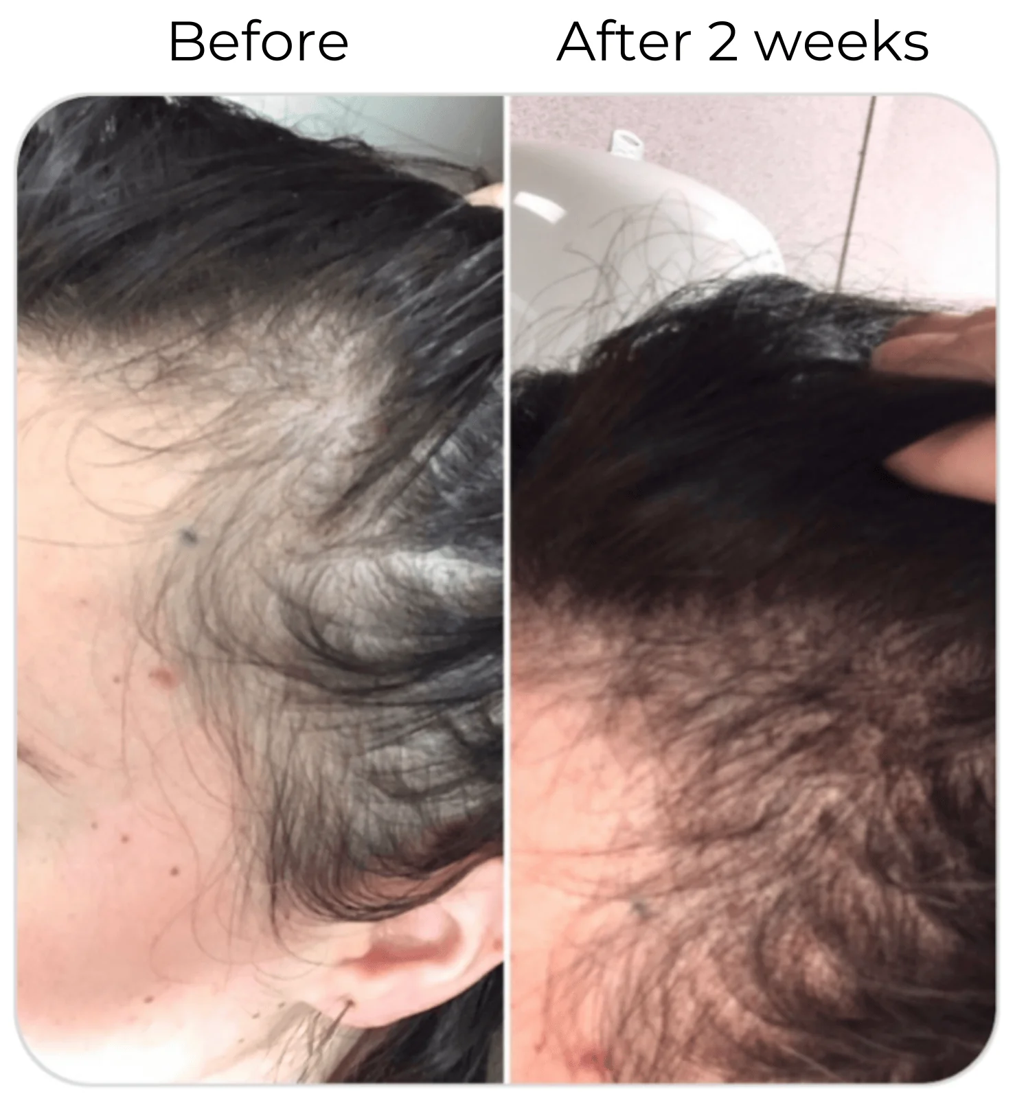 Vegan Hair Strengthening Serum – Natural Relief for Hair Loss & Itchy Scalp - Image 22