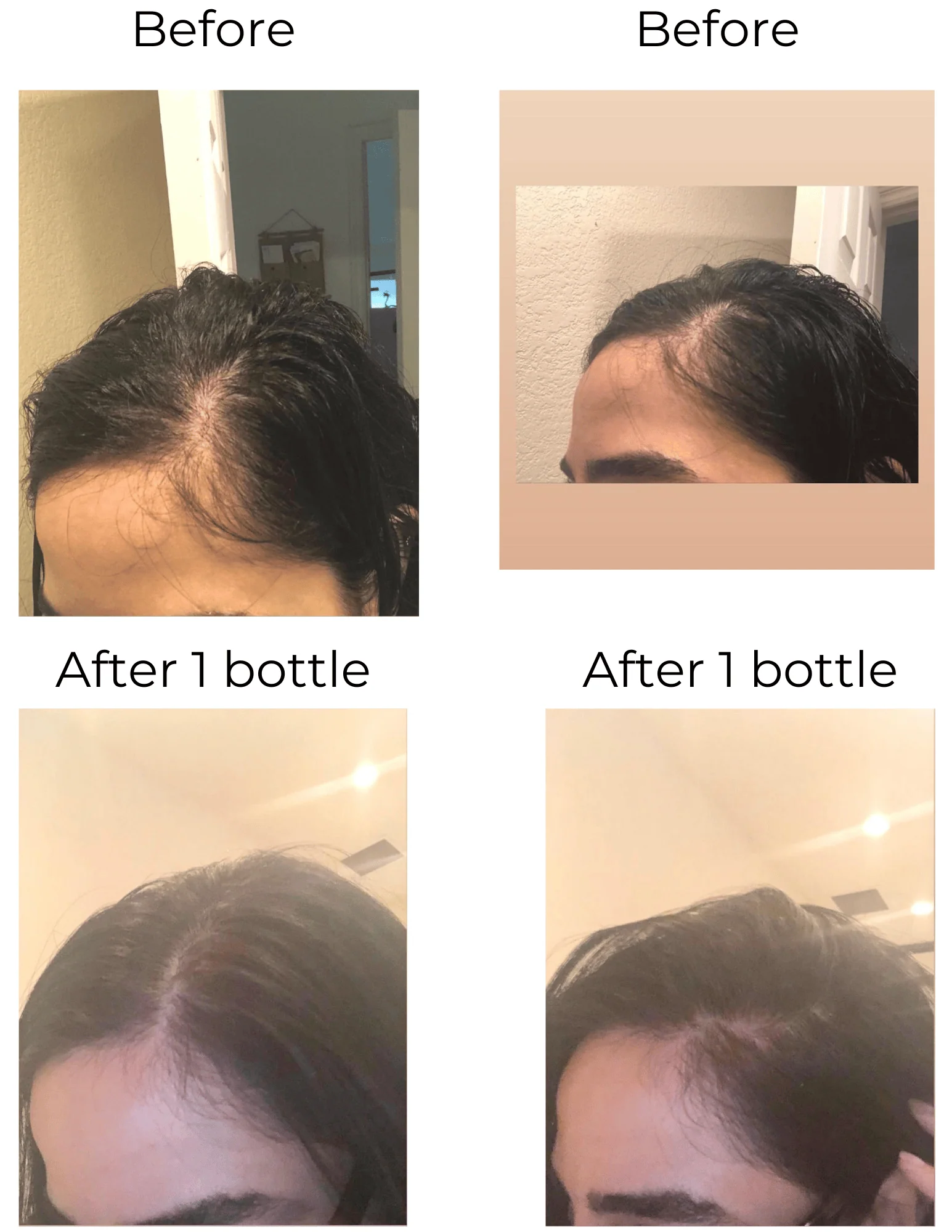Vegan Hair Strengthening Serum – Natural Relief for Hair Loss & Itchy Scalp - Image 24