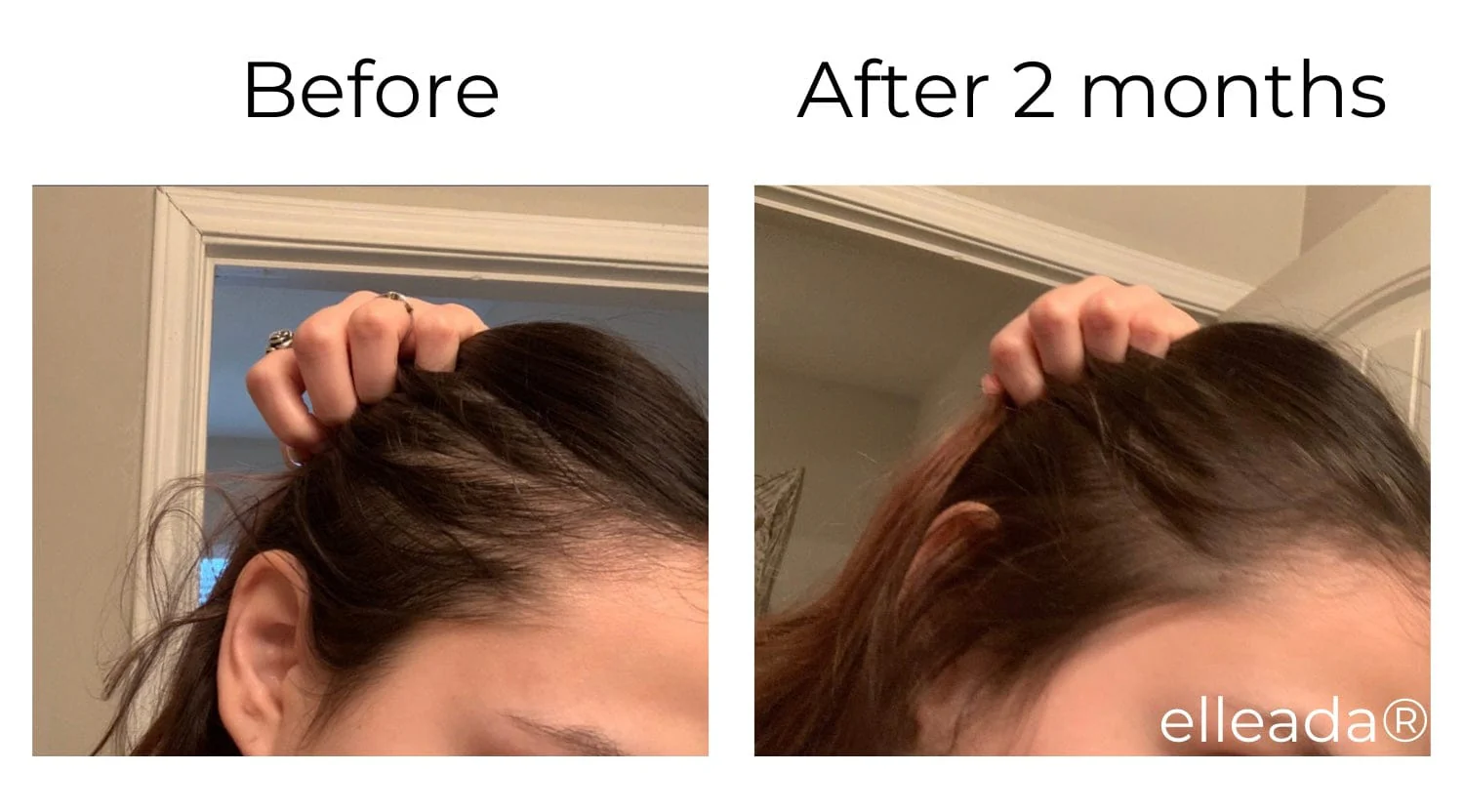 Vegan Hair Strengthening Serum – Natural Relief for Hair Loss & Itchy Scalp - Image 25