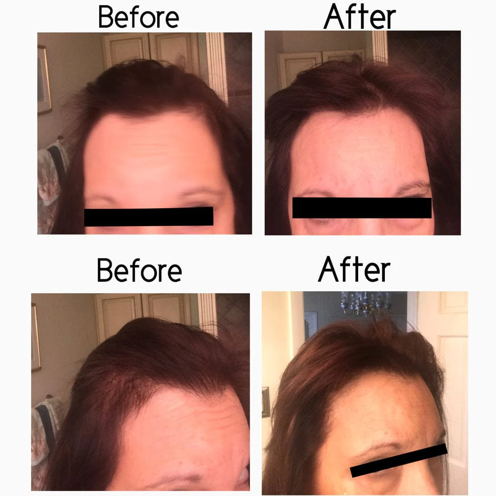 Vegan Hair Strengthening Serum – Natural Relief for Hair Loss & Itchy Scalp - Image 27