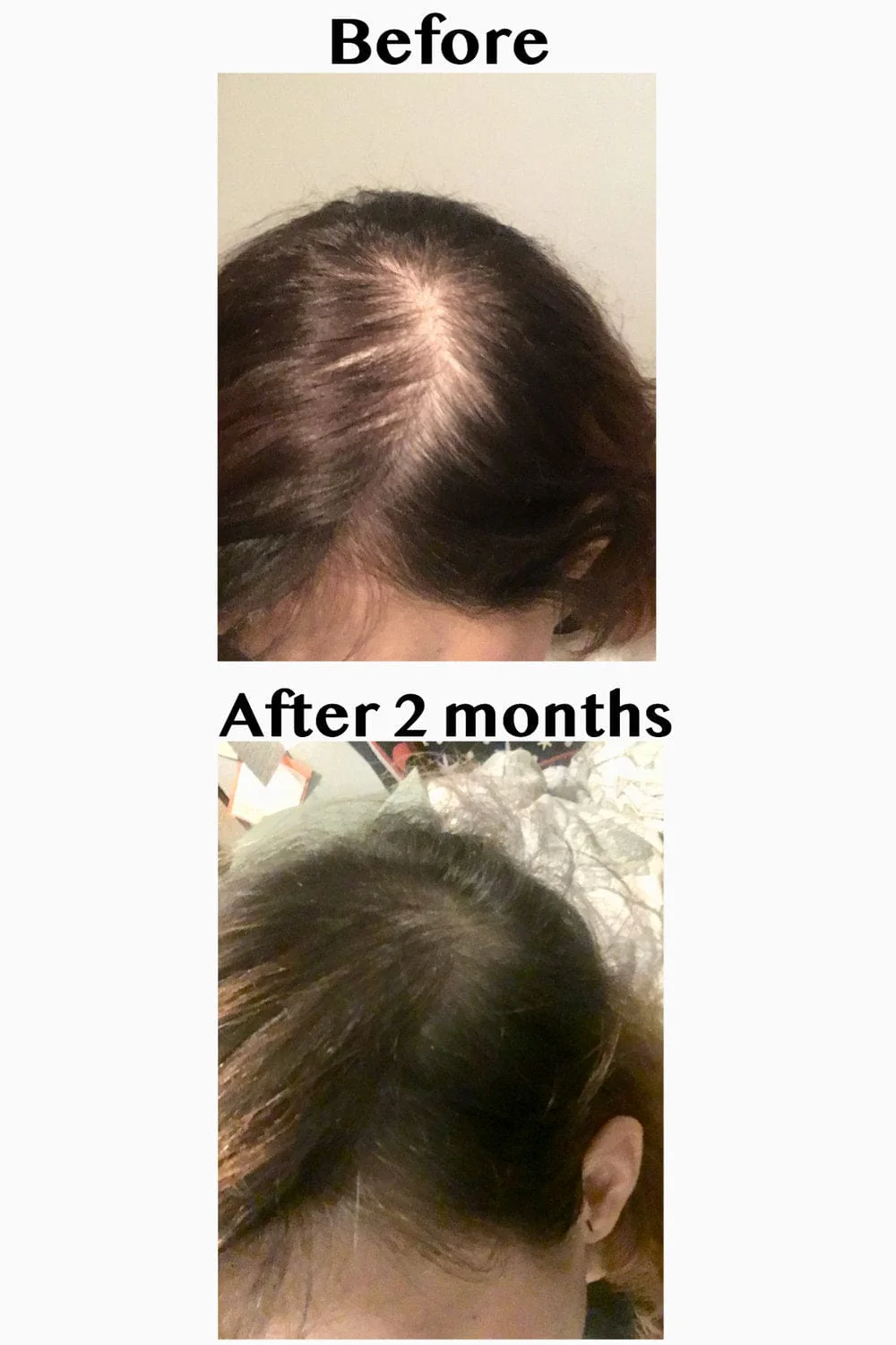 Vegan Hair Strengthening Serum – Natural Relief for Hair Loss & Itchy Scalp - Image 28