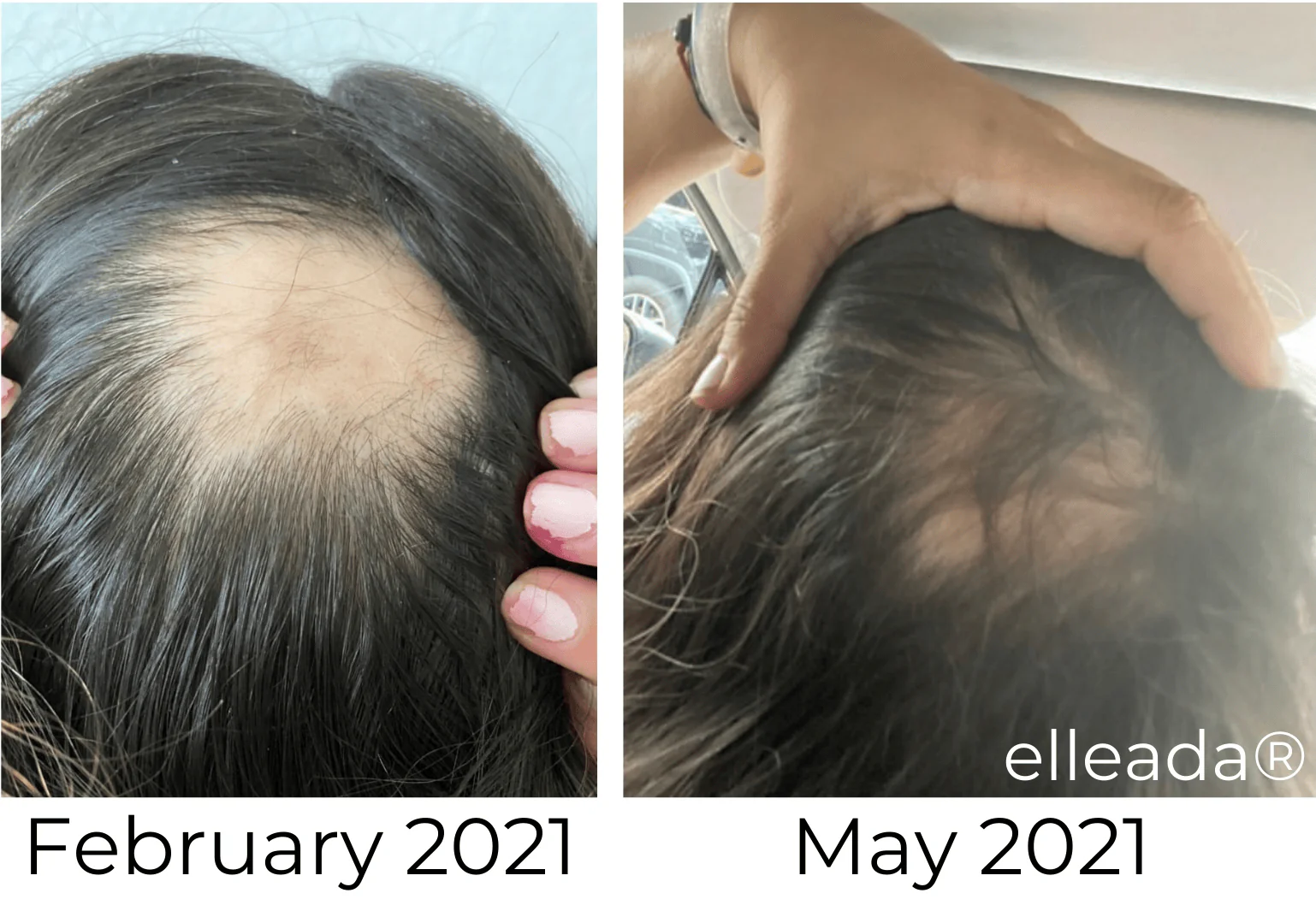 Vegan Hair Strengthening Serum – Natural Relief for Hair Loss & Itchy Scalp - Image 4