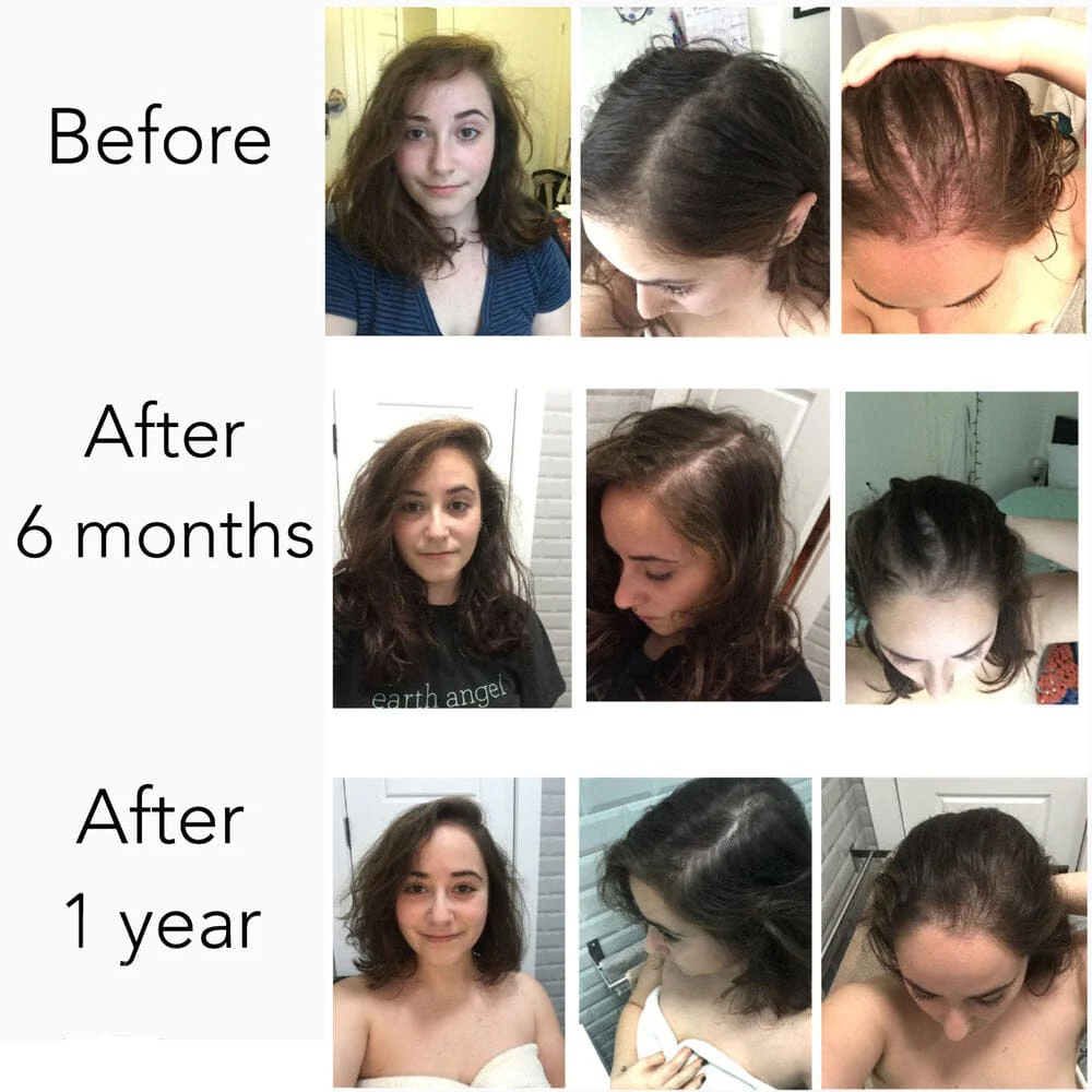Vegan Hair Strengthening Serum – Natural Relief for Hair Loss & Itchy Scalp - Image 6