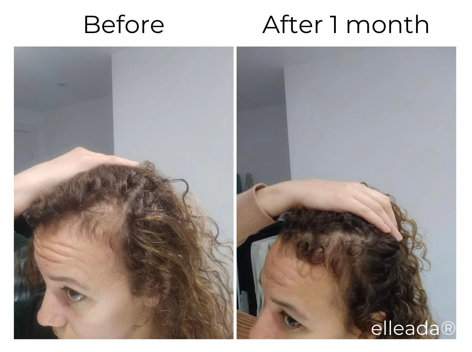 Vegan Hair Strengthening Serum – Natural Relief for Hair Loss & Itchy Scalp - Image 8