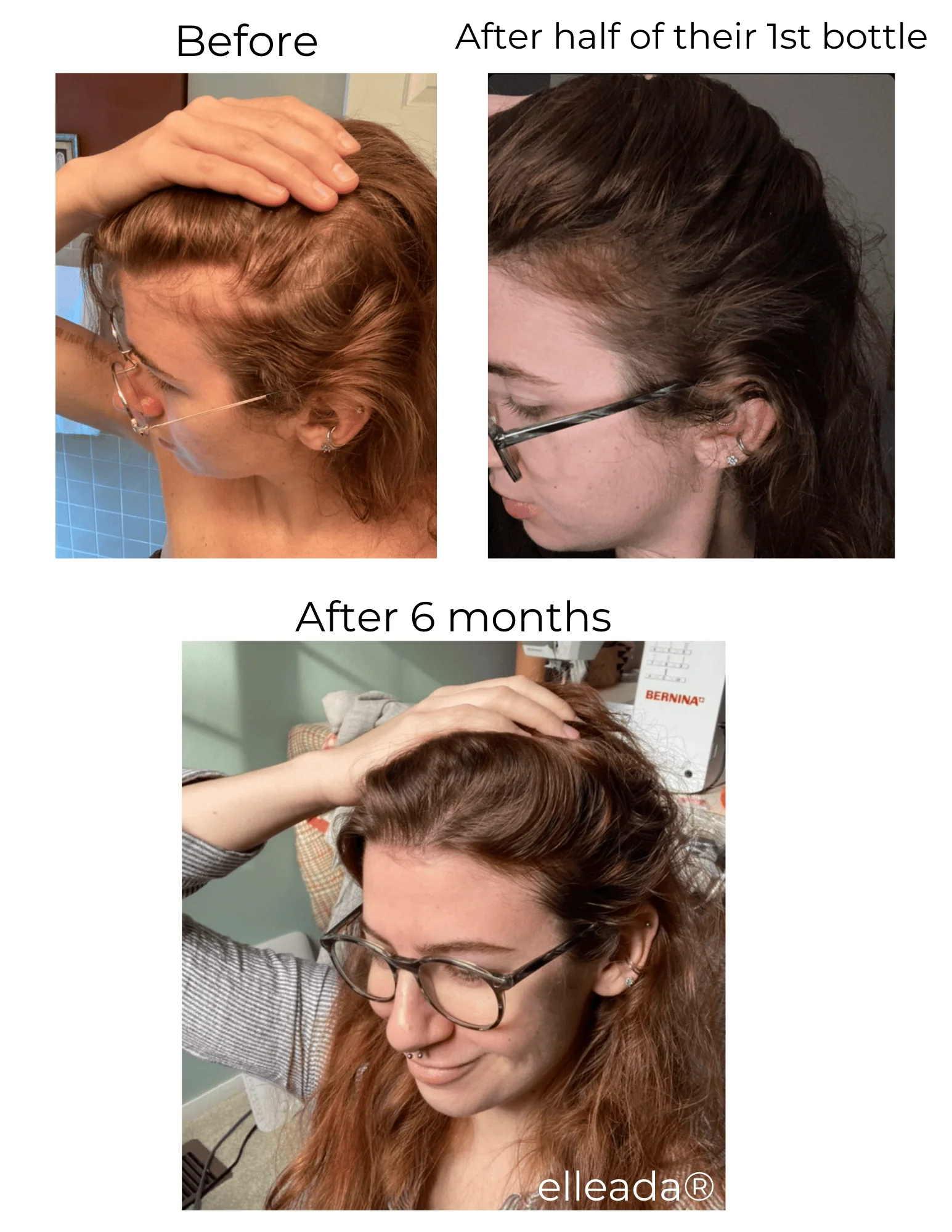 Vegan Hair Strengthening Serum – Natural Relief for Hair Loss & Itchy Scalp - Image 9