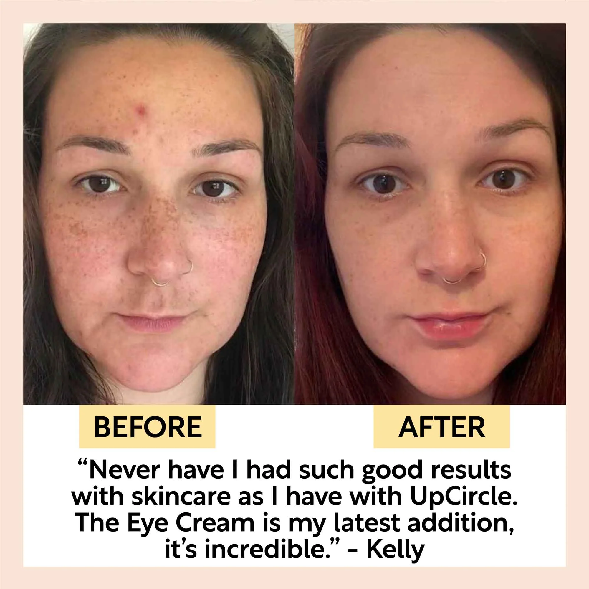 Eye Cream - Image 9