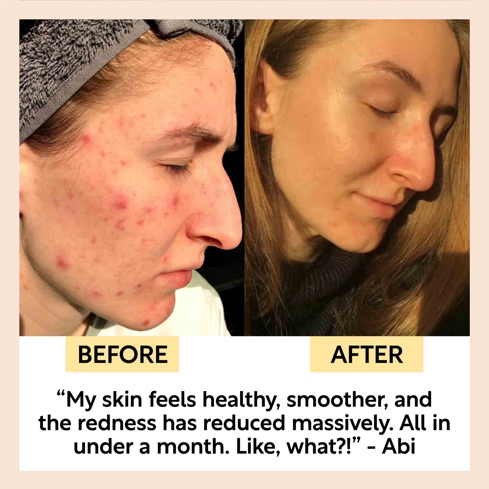 Clarifying Kaolin Clay Face Mask - Image 3