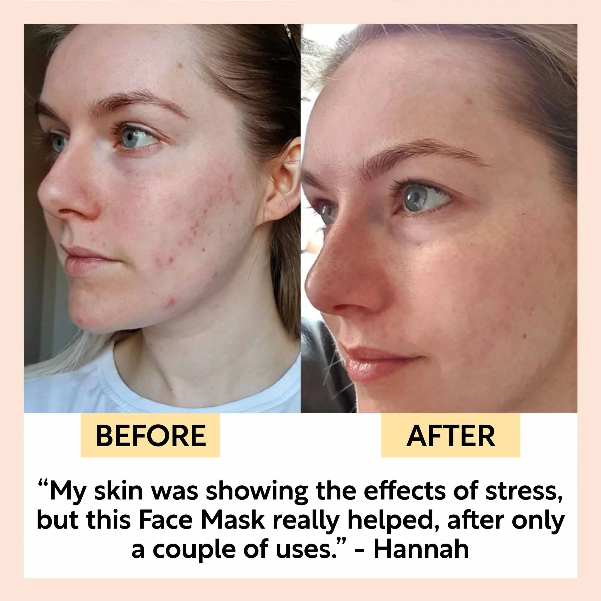 Clarifying Kaolin Clay Face Mask - Image 5