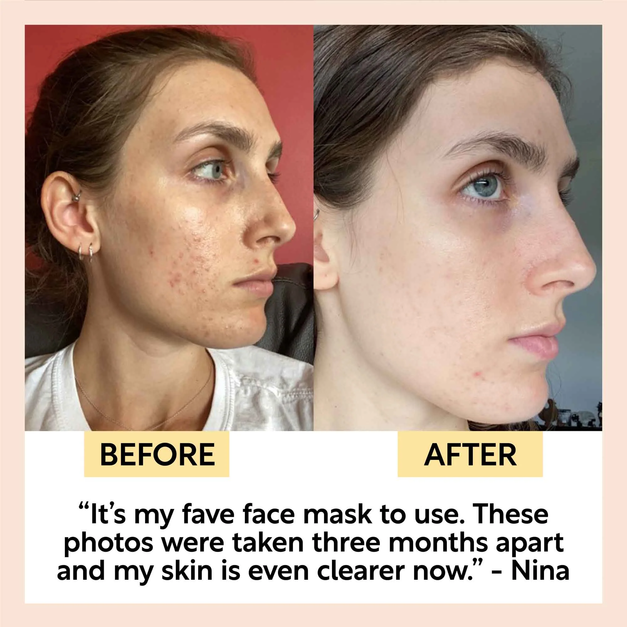 Clarifying Kaolin Clay Face Mask - Image 8