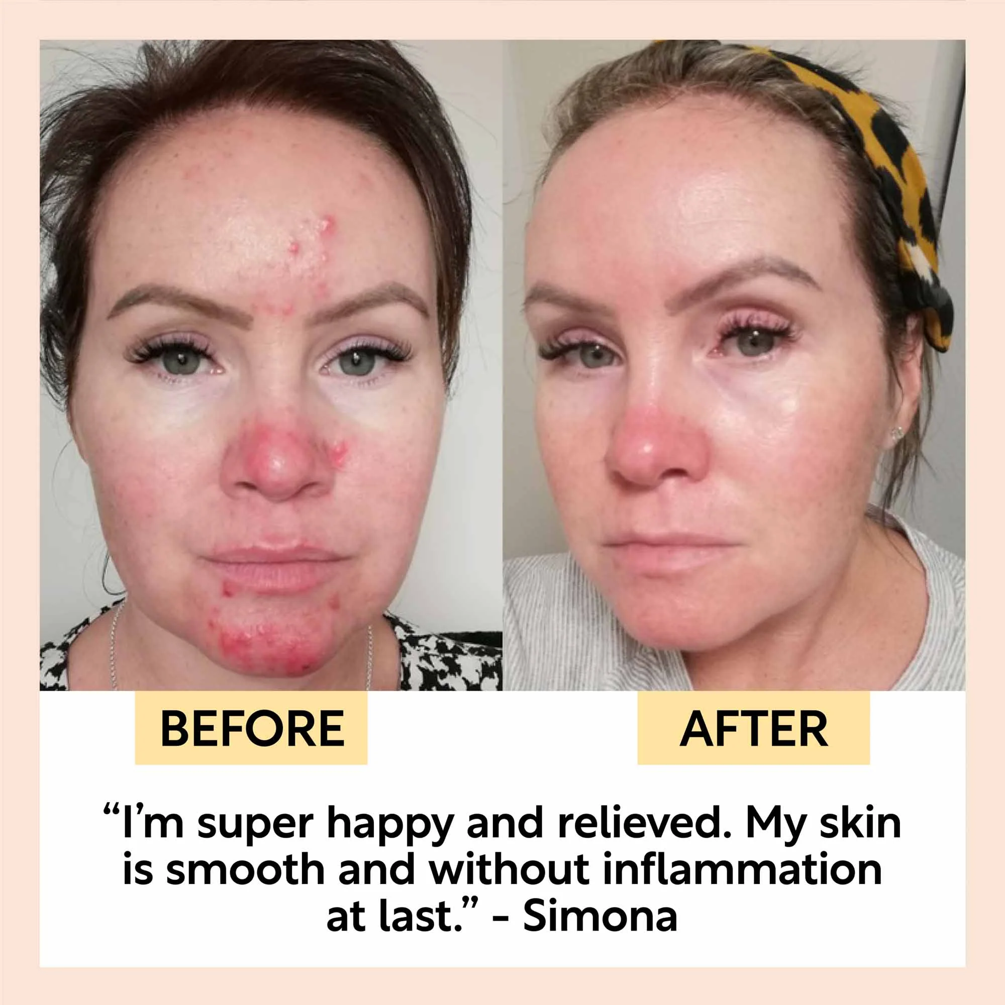 The Sensitive Skin Bundle - Image 7